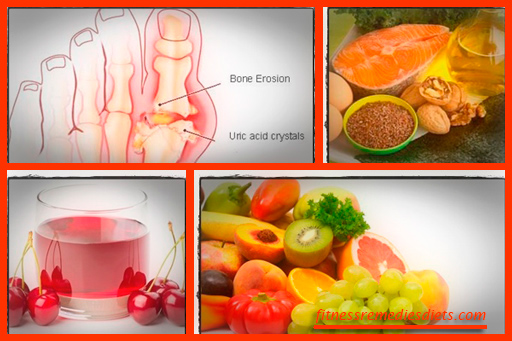 How To Treat Gout? Treatment For Gout With Home Remedies For Gout 