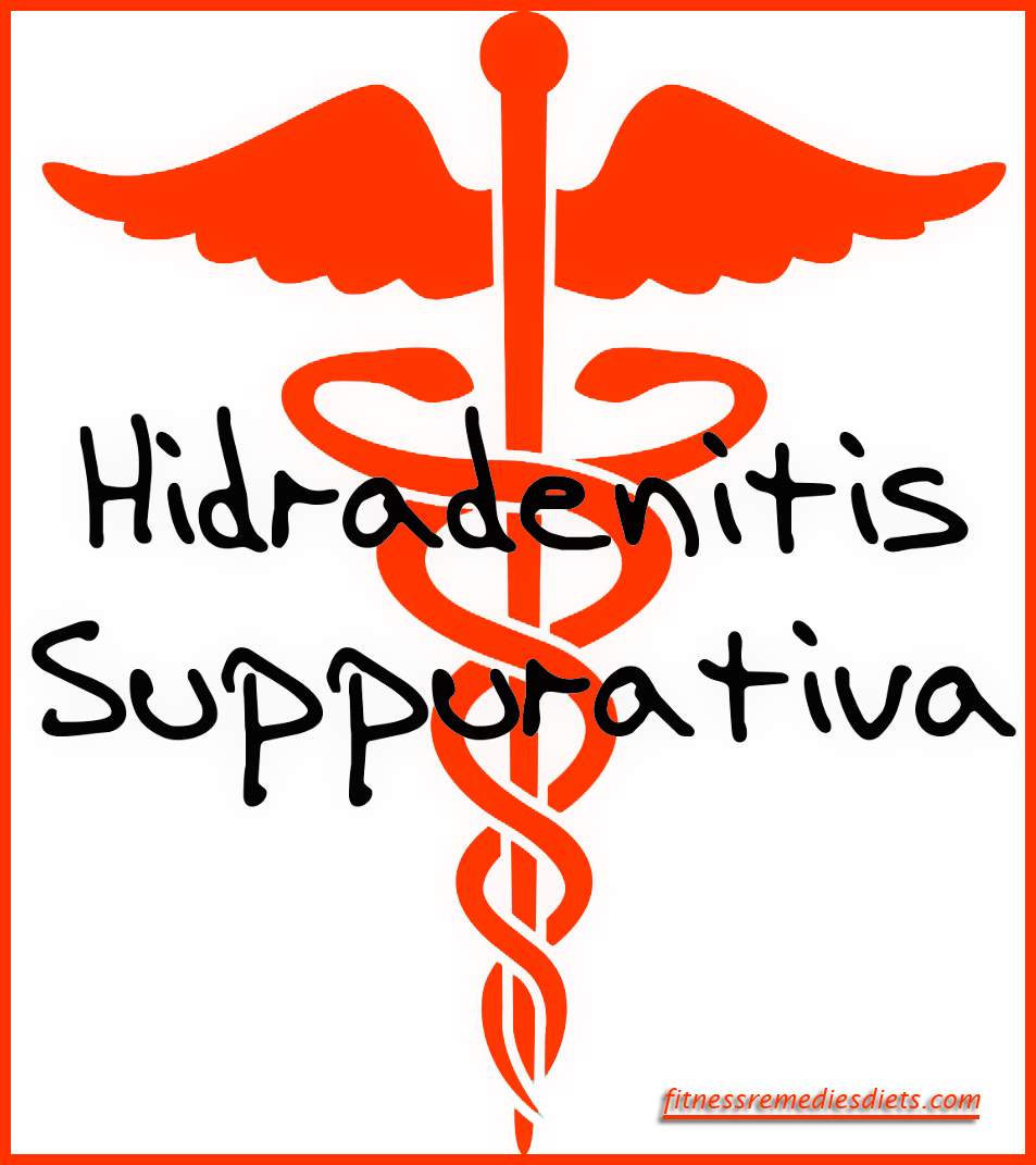 Treatment - Hidradenitis suppurativa - Mayo Clinic