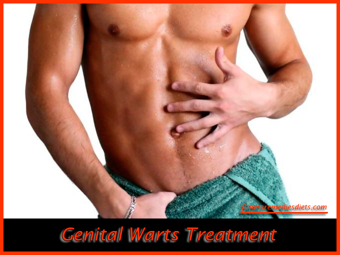 how to remove genital warts