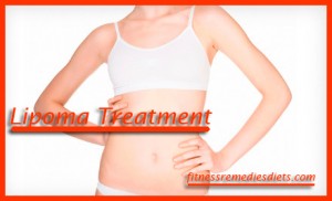 lipoma treatment