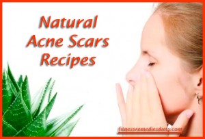 natural-acne-scar-treatments