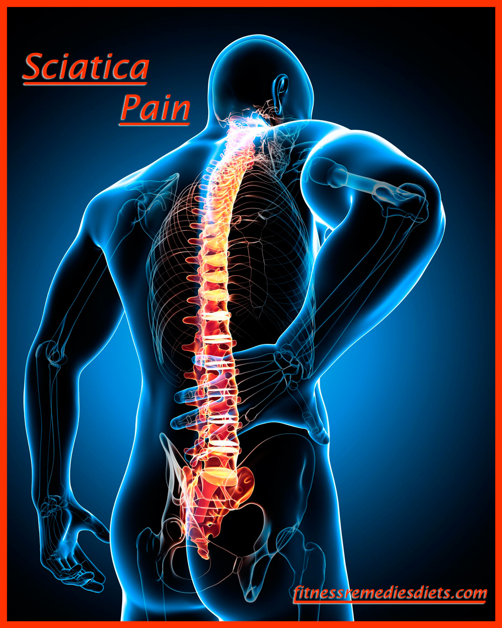 sciatica back pain