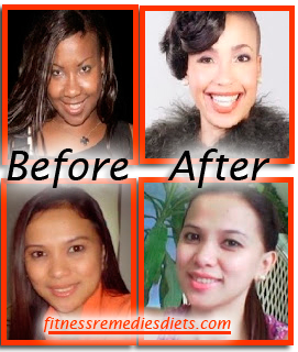 Home Skin Whitening Before After